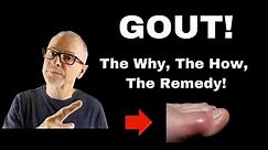 Gout: The Why, The How, The Remedy!