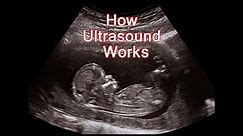 How Ultrasound Machine Works - Animated