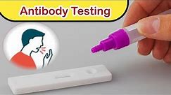 Antibody Titer Test|| Serology Test #antibody #covid19