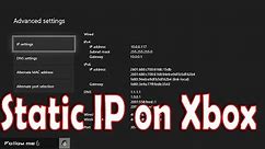 How to Setup Static IP on Xbox One