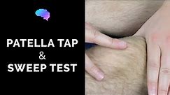 Patella Tap & Sweep Test - OSCE Guide | Clip | UKMLA | CPSA