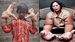 Unusual People With Extraordinary Body Parts