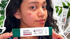 I TRIED SUPER MIRACLE SPOT CREAM BY SOME BY MI FOR 14 DAYS STRAIGHT (BEFORE AND AFTER RESULT)