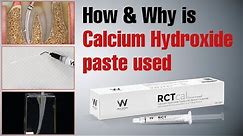 How & Why is Calcium Hydroxide paste used | Waldent RCTcal