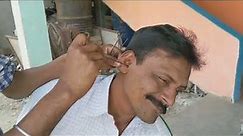 Letest ear cleaning by road side ear cleaner | satisfying ear cleaning with medicine | ear wax