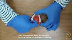 How to Remove/Wear Clear Aligners 3 Easy Simple Ways | 32 Watts