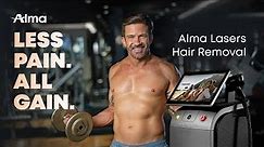 ALMA LASERS HAIR REMOVAL: Less Pain. All Gain.