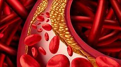 What Is Cholesterol?