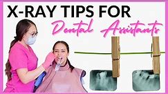 HOW TO TAKE DENTAL XRAYS | Tips for Dental Assistants