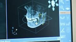 Close-up of doctor dentist looks at looks 3d model of x-rays of the patient's jaw and teeth on the monitor, modern dentistry