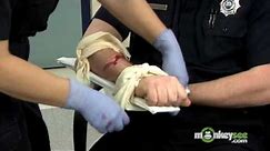 How to Splint a Broken Arm