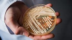 CDC warns of drug-resistant fungus