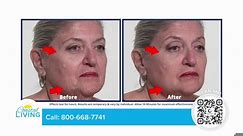 Paid For By: Plexaderm - Visibly Reduces Under-Eye Bags & Wrinkles