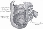 Afbeeldingsresultaten voor Ileocecal valve. Grootte: 145 x 100. Bron: radiopaedia.org