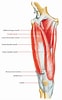 Image result for Musculus Gracilis Slagader. Size: 62 x 100. Source: www.earthslab.com