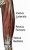 Image result for "palapedia Quadriceps". Size: 60 x 100. Source: fity.club