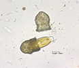 Image result for "condonariacistellula". Size: 116 x 100. Source: microfloraenfauna.com