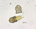 Image result for "codonella Perforata". Size: 124 x 100. Source: microfloraenfauna.com