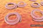 Image result for "rhabdonella Spiralis". Size: 150 x 100. Source: focusedcollection.com