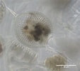 Image result for "Protocystis Swirei". Size: 113 x 100. Source: plankton.mio.osupytheas.fr