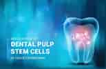 dental Pulp stem Cell Clusters ਲਈ ਪ੍ਰਤੀਬਿੰਬ ਨਤੀਜਾ. ਆਕਾਰ: 154 x 100. ਸਰੋਤ: www.kosheeka.com