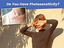 Image result for Photosensitivity to the Sun. Size: 132 x 100. Source: www.onlymyhealth.com