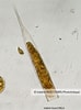 Image result for "Helicostomella subulata". Size: 74 x 100. Source: images.cnrs.fr