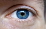 Résultat d’image pour Pupille des yeux. Taille: 158 x 100. Source: cliniquebellevue.com