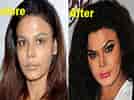 Rakhi Sawant Before and After Surgery-க்கான படிம முடிவு. அளவு: 134 x 100. மூலம்: www.newstrend.news
