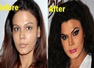 Image result for Rakhi Sawant Surgery. Size: 138 x 100. Source: www.newstrend.news