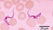 Image result for "botrynema Brucei". Size: 172 x 100. Source: parasitology.ou.ac.lk