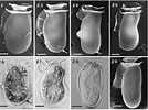 Image result for "dinophysis Sacculus". Size: 134 x 100. Source: www.researchgate.net