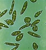 Image result for "rhynchonerella Gracilis". Size: 92 x 100. Source: eukaryoticmicrobe.blogspot.com