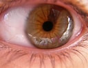 Image result for "heterochromia Papyrifera". Size: 128 x 100. Source: commons.wikimedia.org