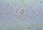 Image result for "Protocystis Swirei". Size: 140 x 100. Source: phil.cdc.gov