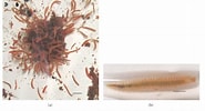 Afbeeldingsresultaten voor "ophryotrocha Maculata". Grootte: 185 x 100. Bron: www.semanticscholar.org