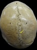 Bildergebnis für Foramen parietale Permagnum. Größe: 74 x 100. Quelle: www.researchgate.net