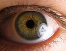 Résultat d’image pour Pupille des yeux. Taille: 129 x 100. Source: www.wikidoc.org