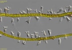 Afbeeldingsresultaten voor "acineta Tuberosa". Grootte: 144 x 100. Bron: realmicrolife.com