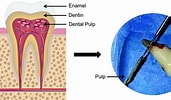 Image result for Dental Pulp stem cell Clusters. Size: 171 x 100. Source: www.liebertpub.com