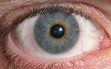 Image result for "heterochromia Papyrifera". Size: 160 x 100. Source: en.wikipedia.org