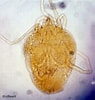 Afbeeldingsresultaten voor Pseudodromia latens anatomie. Grootte: 95 x 100. Bron: keys.lucidcentral.org
