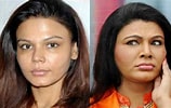 Image result for Rakhi Sawant Surgery. Size: 158 x 100. Source: www.surgerymiracles.com