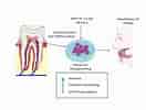 Dental Pulp Stem Cell Clusters ಗಾಗಿ ಇಮೇಜ್ ಫಲಿತಾಂಶ. ಗಾತ್ರ: 132 x 100. ಮೂಲ: www.mdpi.com