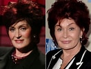 Image result for Sharon Osbourne Before Surgery. Size: 132 x 100. Source: www.celebplasticsurgeryonline.com