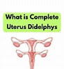 Image result for Uterus Didelphys. Size: 92 x 100. Source: www.thenursepage.com