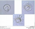 Image result for "strobilidium Typicum". Size: 118 x 100. Source: www.photomacrography.net
