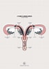 Image result for Uterus Didelphys. Size: 71 x 100. Source: fity.club