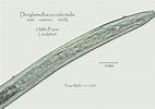 Image result for "doliolina Muelleri". Size: 142 x 100. Source: nematode.unl.edu