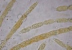 Image result for Calciodinellaceae. Size: 143 x 100. Source: mycologues-associes.fr